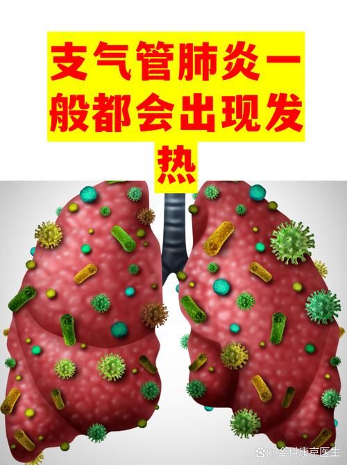 【陇西县新增20例阳性感染者及16例无症状,陇西新型肺炎疫情最新消息】