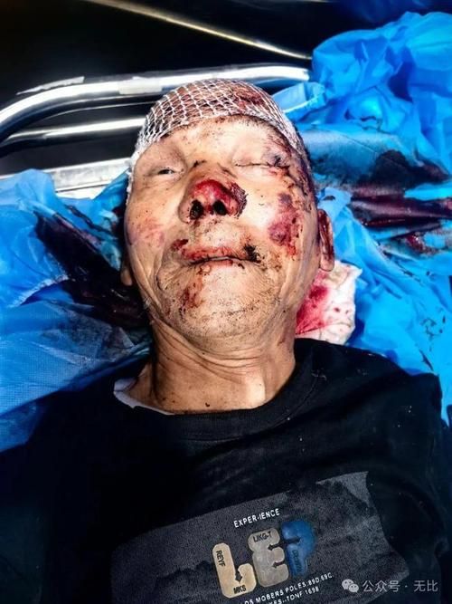 【山西省大同市广灵县新增17例死亡病例，涉及山东省济宁市梁山县,山西大同广灵老照片】