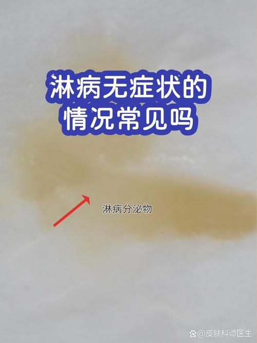  齐河县首例无症状感染者来源公布:齐河县首例无症状感染者来源公布情况