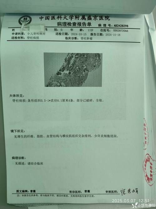  广东东莞东城街道累计报告死亡病例1例:东莞东城疑似病例