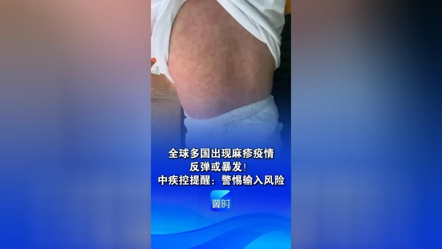 10地疫情存反弹风险(疫情反弹风险仍存在)