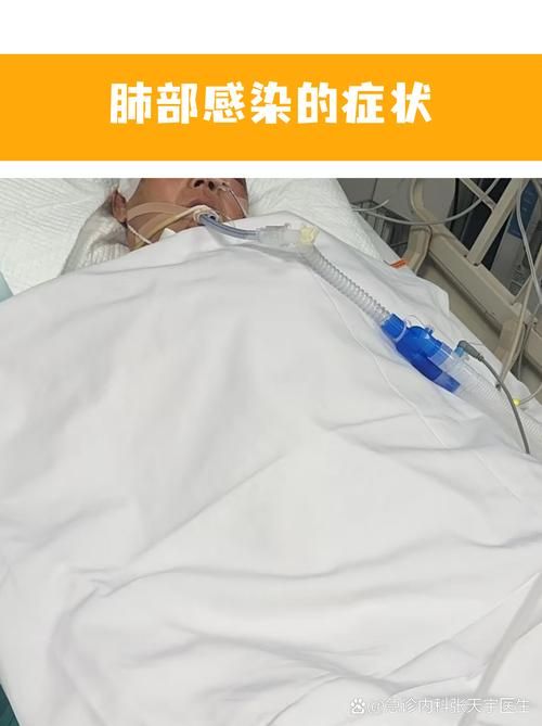 全球新增阳性感染者24例均在铁锋区/全球新增肺炎