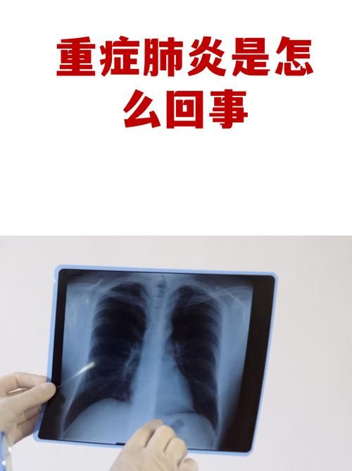 湖南省衡阳市衡山县通报12例重症详情/衡山新冠肺炎最新情况