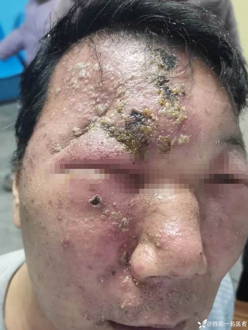 青海省果洛藏族自治州近期新增10例无症状感染者/青海果洛的人怎么样