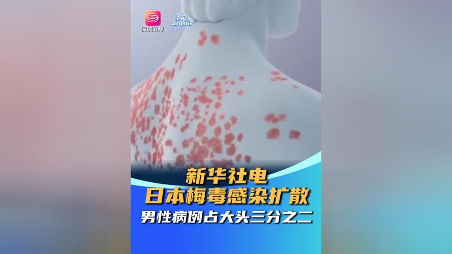 东台市近期新增阳性感染者15例(东台出现疫情)